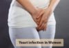 Vaginal Yeast Infection, Trend Health