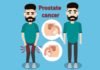 Prostate Cancer, Trend Health