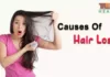 Causes Of Hair Loss, Trend Health