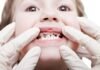 Major Pediatric Dental Issues, Trend Health