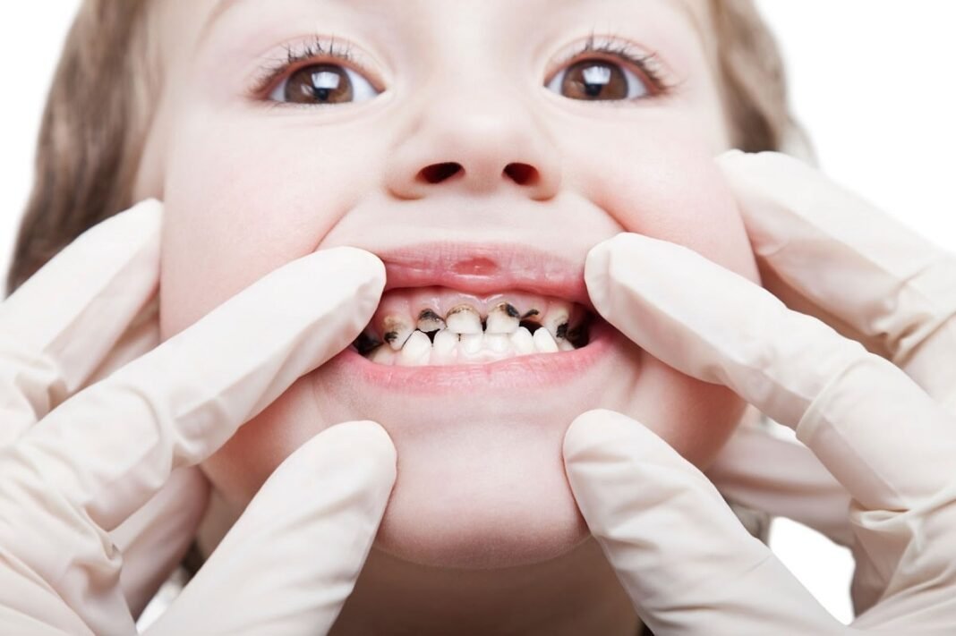 Major Pediatric Dental Issues, Trend Health