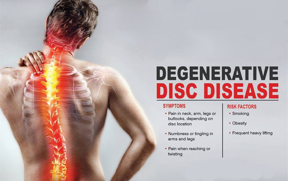 What is Degenerative Disc Disease
